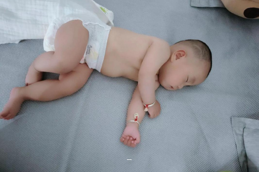 香港宝宝脸上有白色斑块